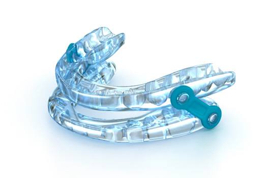 An oral appliance near Oak Ridge