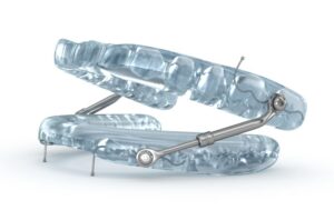 Oral appliance for sleep apnea against white background